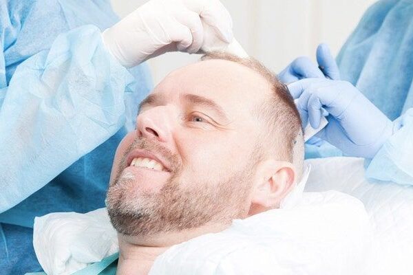 Hair Transplant in Turkey for Foreigners